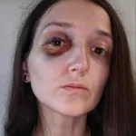 У Львові в трамваї підліток побив пасажирку. Поліція відкрила кримінальне провадження