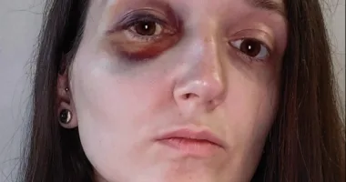 У Львові в трамваї підліток побив пасажирку. Поліція відкрила кримінальне провадження