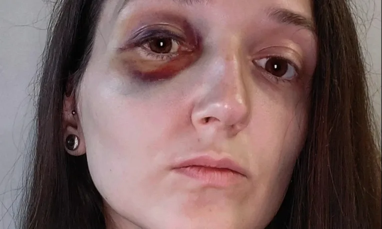 У Львові в трамваї підліток побив пасажирку. Поліція відкрила кримінальне провадження