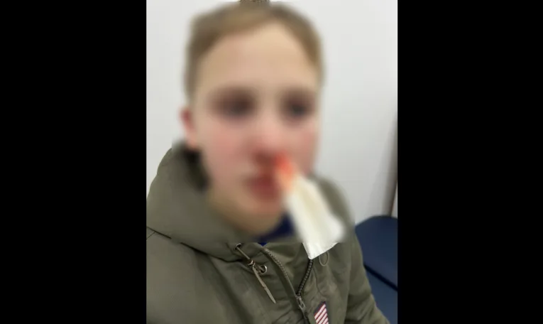 У Львові чоловік побив 11-річну дитину під час катання на санчатах