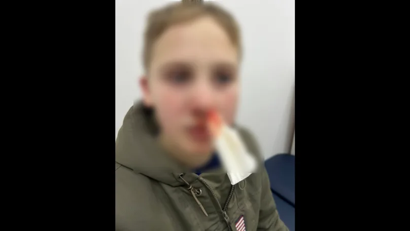 У Львові чоловік побив 11-річну дитину під час катання на санчатах