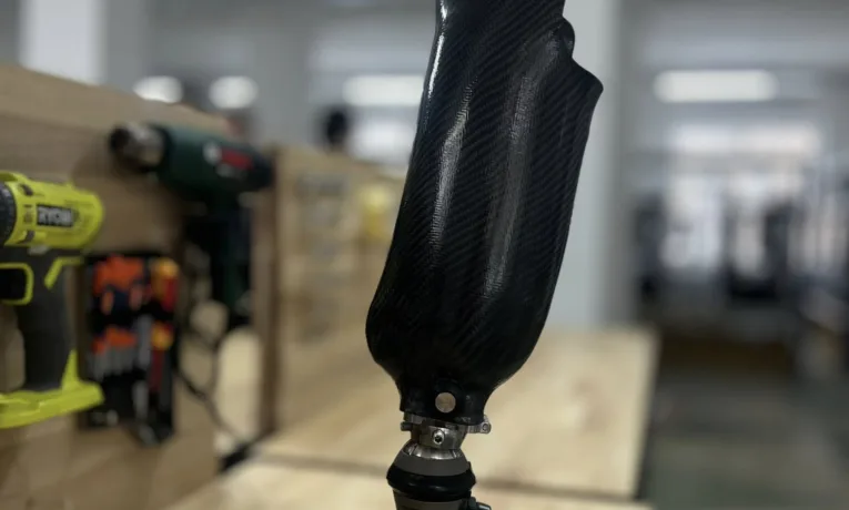 У Львові запрацювала найбільша в Європі навчально-виробнича протезна майстерня