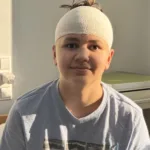 У Львові лікарі видалили рідкісну пухлину головного мозку 12-річному хлопчику