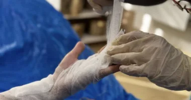 Львівські лікарі врятували пальці директорці ліцею після важкої травми на зіплайні за кордоном