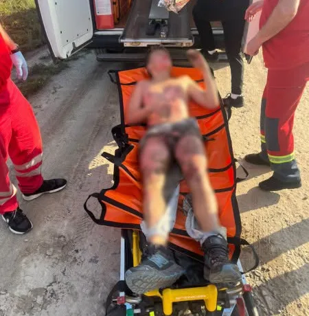 У Львові 13-річний хлопець отримав опіки після ураження струмом на вагоні-цистерні