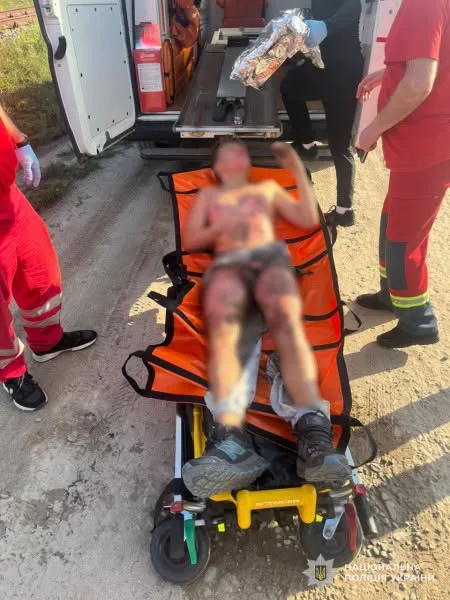 У Львові 13-річний хлопець отримав опіки після ураження струмом на вагоні-цистерні